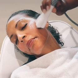 Infuse Wellness - RF Skin tightening with Venus Legacy Diamondpolar