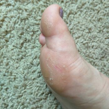 Lavish Nails & Spa - Awful and lazy attempt at callus removal. A minute of pumice stone or foot file application would have solved this... - Nail Salons Near Me - Bothell, Washington