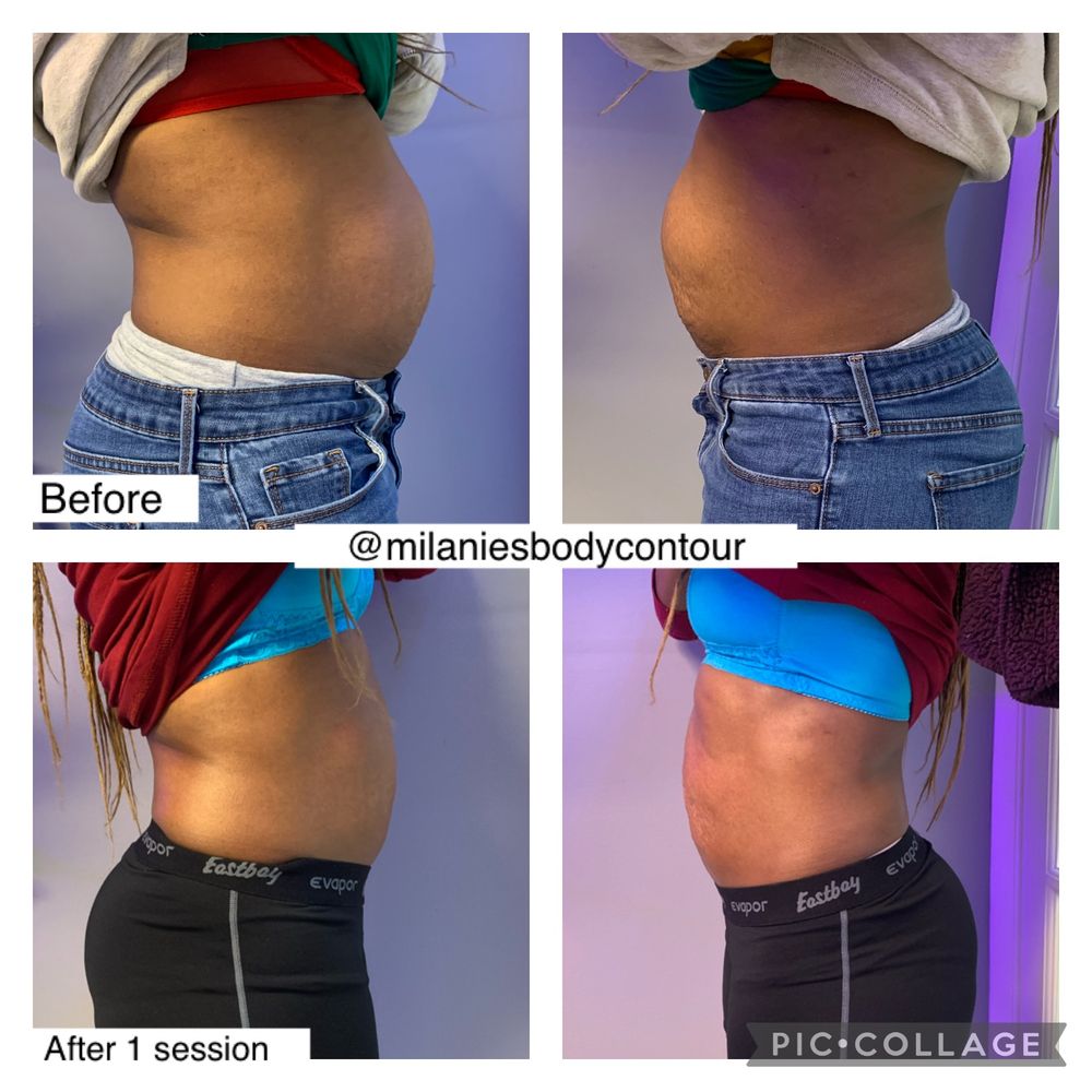 o Jupiter Florida Real Estate For Sale