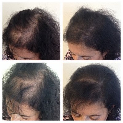 SELAH SKIN CARE & COSMETIC TATTOOING STUDIO - 10 Photos - Hair Loss
