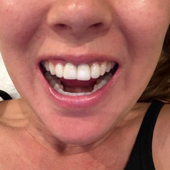 Sam Saleh, DDS - their final work - Cosmetic Dentists Near Me - Beverly Hills, California Sam Saleh, DDS - their final work - Cosmetic Dentists Near Me - Beverly Hills, California
