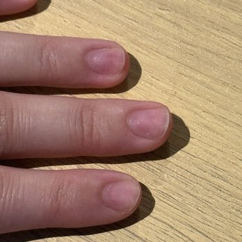 Lavender Nails & Spa - Damaged nails with dents and rings of fire - Nail Salons Near Me - Evanston, Illinois