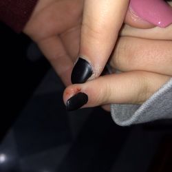 LA Nail Spa - Another finger the lady cut