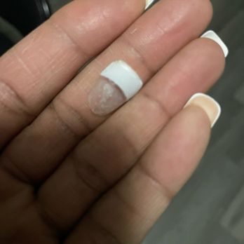 Venetian Nail Spa - Nail that popped after 3 weeks. - Nail Salons Near Me - Plantation, Florida Venetian Nail Spa - Nail that popped after 3 weeks. - Nail Salons Near Me - Plantation, Florida