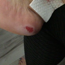 Foot Foot