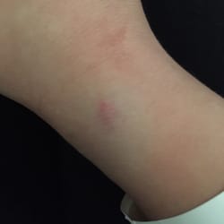 Tri-Valley Ambulatory Surgery Center - Way worse than it looks