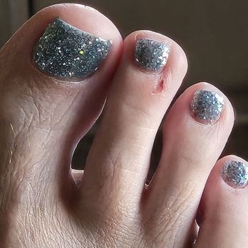 Artist Nails Lounge - The sore on my toe - Nail Salons Near Me - Gilbert, Arizona Artist Nails Lounge - The sore on my toe - Nail Salons Near Me - Gilbert, Arizona