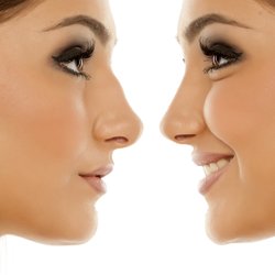 Cosmetic Stem Cell, PRP and nose was hands down the best thing they offer at Cosmo World.