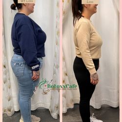 BotoxxCafe - Weight loss goal achieved! Before (left) After (right)