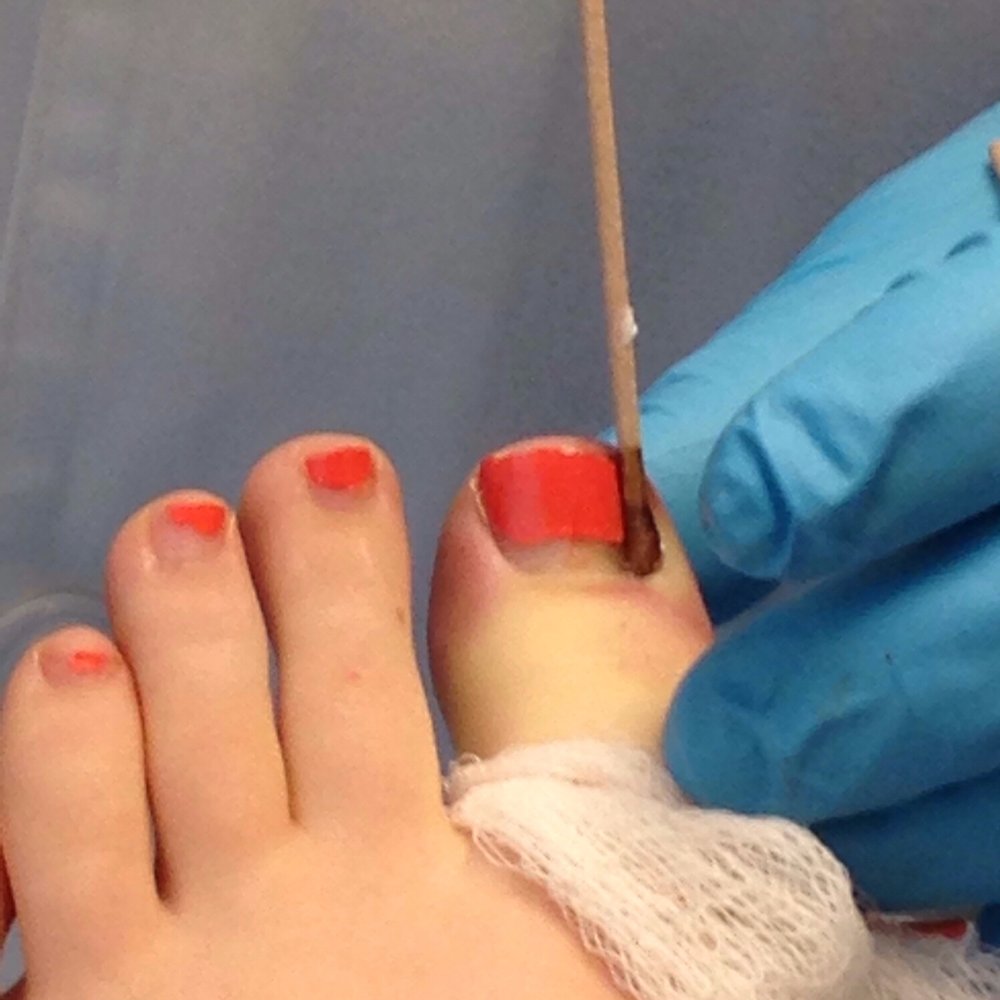Northwest Foot & Ankle Specialists - Podiatrists Near Me - Everett, Washington