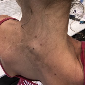 Salt & Light Wellness - My back after I showered - Tanning Beds Near Me - Riverside, California