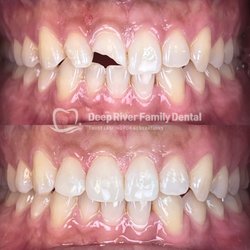 Deep River Family Dental
