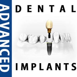 Advanced Dental Implant Center