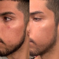 Glowdega - Majestic No. 8 before and after