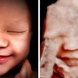 Miracle In The Womb