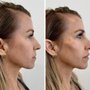 Photo of Injectables by Lisa RN