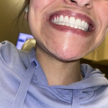 Aspen Dental - Gadsden, AL - General Dentistry Near Me - Gadsden, Alabama Aspen Dental - Gadsden, AL - General Dentistry Near Me - Gadsden, Alabama