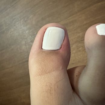 Pearly Nail Spa - infected toe / result rough cuticle care. OUCH - Nail Salons Near Me - Azusa, California