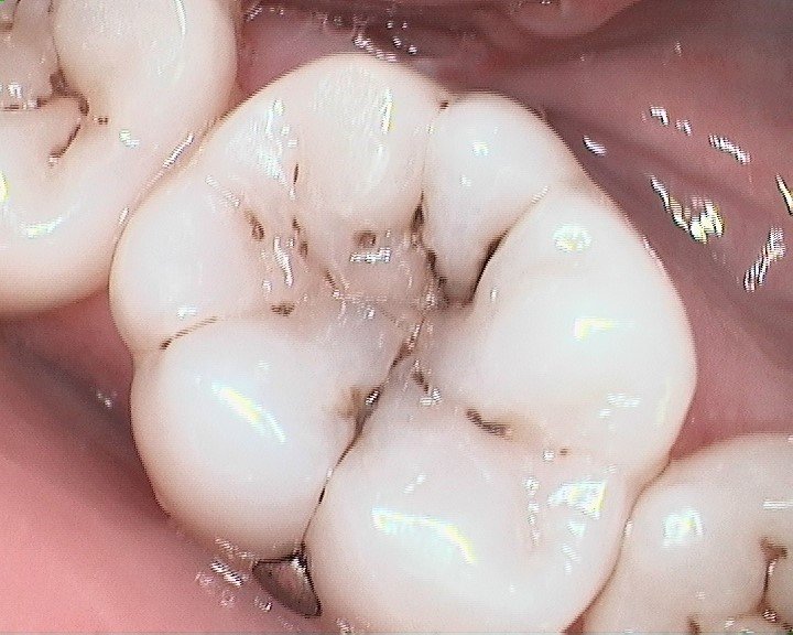 Magnolia Dental - patient advocate in Covington, LA