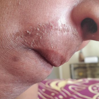 Beauti Mak - Lip area burns?? - Hair Salons Near Me - Las Vegas, Nevada