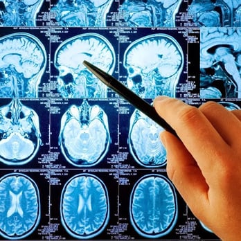 David C McKee, MD - Electromyography Duluth, MN - Neurologist Near Me - Duluth, Minnesota David C McKee, MD - Electromyography Duluth, MN - Neurologist Near Me - Duluth, Minnesota