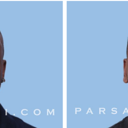 Parsa Mohebi Hair Restoration - Before and After FUE Hair Transplant (1,615). One Procedure. 8 Months Elapsed
