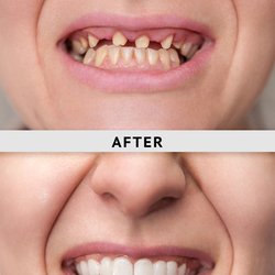 De G Nguyen, DDS - LIFE-CHANGING MODERN DENTAL IMPLANTS