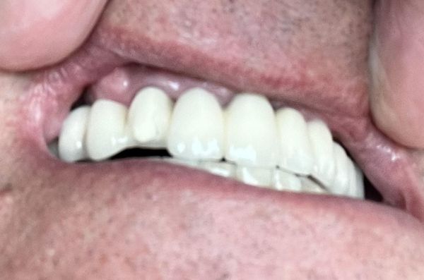 Clear Lake Dental Care