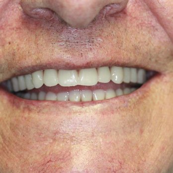 Demetrios Bayiokos DMD - General Dentistry Near Me - Fort Lee, New Jersey Demetrios Bayiokos DMD - General Dentistry Near Me - Fort Lee, New Jersey