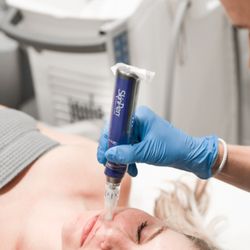AYA Medical Spa Colony Square - Midtown - SkinPen treatment at AYA in Atlanta GA