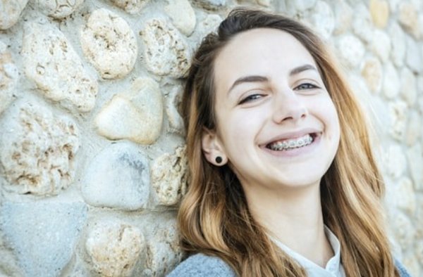 Braces - Why Get Braces
When making a decision about whether or not to undergo a braces treatment, we want you to feel as informed and empowered as you possibly can.
Creating a beautiful smile
For most people, a beautiful smile is the most obvious benefit of braces. At Leber Ortho our mission is to provide our patients with beautiful smiles and to see them Smile Big. When you meet with Dr. Eric Leber, he will take the time to get to know you so he can create a treatment plan that meets your individual needs. Don't worry - age is not an issue! If you are looking for braces for a child or braces for an adult, we can provide a dental plan to help you reach your goal.
Establishing proper function of the teeth
Getting braces will not only provide you with a beautiful smile but will provide proper dental function. Through your orthodontic treatment at Leber Ortho, we will help resolve any problems like crooked and crowded teeth, overbites or underbites, incorrect jaw position and other jaw related disorders. The lasting benefits of proper functioning teeth include:
Straight teeth are easier to clean, which may prevent tooth decay and gum disease
Proper dental function will decrease the abnormal wear of tooth surfaces and improve speaking, biting and chewing functions
At Leber Ortho we can provide you with the right orthodontic treatment to provide you with a beautiful smile and properly functioning teeth. Call Today for your FREE consultation! Braces - Why Get Braces
When making a decision about whether or not to undergo a braces treatment, we want you to feel as informed and empowered as you possibly can.
Creating a beautiful smile
For most people, a beautiful smile is the most obvious benefit of braces. At Leber Ortho our mission is to provide our patients with beautiful smiles and to see them Smile Big. When you meet with Dr. Eric Leber, he will take the time to get to know you so he can create a treatment plan that meets your individual needs. Don't worry - age is not an issue! If you are looking for braces for a child or braces for an adult, we can provide a dental plan to help you reach your goal.
Establishing proper function of the teeth
Getting braces will not only provide you with a beautiful smile but will provide proper dental function. Through your orthodontic treatment at Leber Ortho, we will help resolve any problems like crooked and crowded teeth, overbites or underbites, incorrect jaw position and other jaw related disorders. The lasting benefits of proper functioning teeth include:
Straight teeth are easier to clean, which may prevent tooth decay and gum disease
Proper dental function will decrease the abnormal wear of tooth surfaces and improve speaking, biting and chewing functions
At Leber Ortho we can provide you with the right orthodontic treatment to provide you with a beautiful smile and properly functioning teeth. Call Today for your FREE consultation!