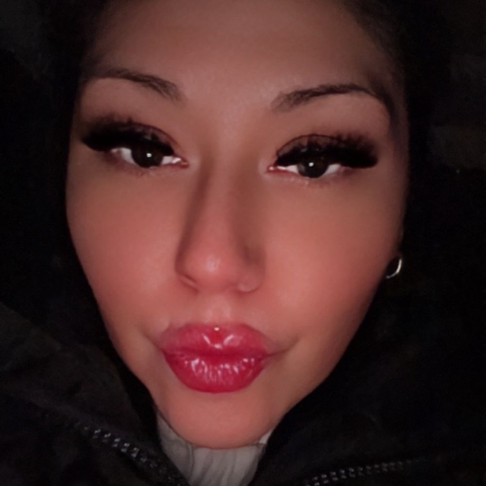 Ideal Image Maple Grove - The evening after getting my lip filler, trying to blow a kiss and show how swollen they Really were for the 1st day!! - Laser Hair Removal Near Me - Maple Grove, Minnesota