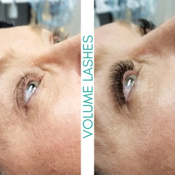 SkinSPArations - Skin Care Near Me - Appleton, Wisconsin
