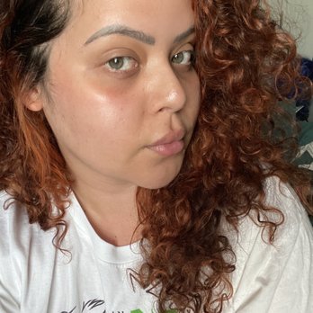 LaserAway - 1 day post clear + brilliant and .33 of the lip filler - Tattoo Removal Near Me - Woodland Hills, California