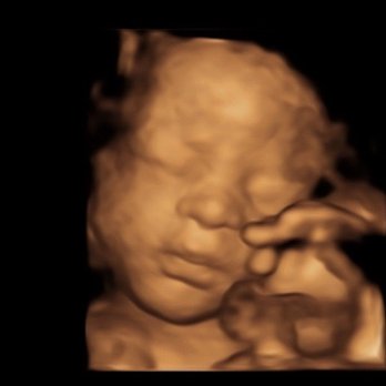The Baby Connection - Diagnostic Imaging Near Me - Sacramento, California The Baby Connection - Diagnostic Imaging Near Me - Sacramento, California