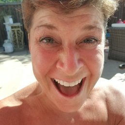 Andye' s new veneers! Andye' s new veneers!