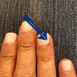 Nails Club - C bad cut here and it kept bleeding.