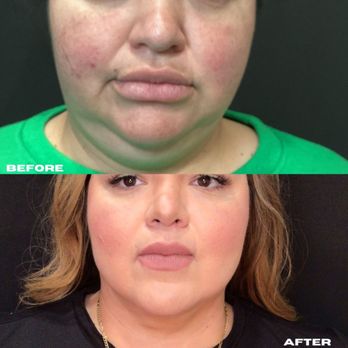 The Botox Bar and Aesthetics - Aestheticians Near Me - Dallas, Texas The Botox Bar and Aesthetics - Aestheticians Near Me - Dallas, Texas