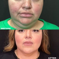 The Botox Bar and Aesthetics
