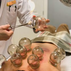 Promise Integrative Medicine Clinic - Fire Cupping Treatment