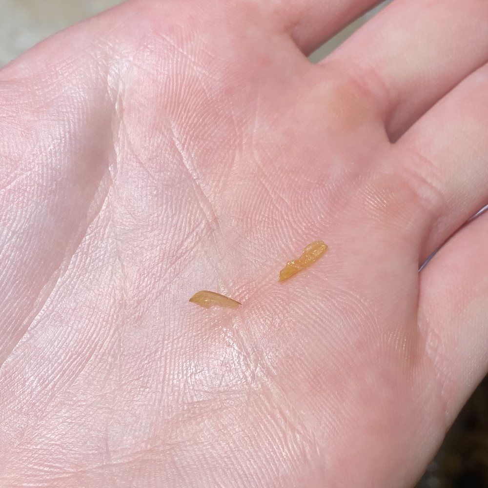 Razor sharp pieces found all throughout food Razor sharp pieces found all throughout food