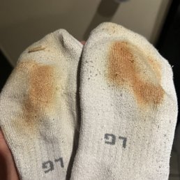 From carpet. Ruined several pairs of socks From carpet. Ruined several pairs of socks