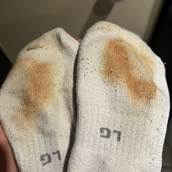 St Giles Hotel - From carpet. Ruined several pairs of socks