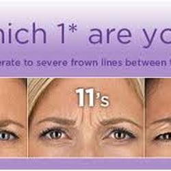 Botox