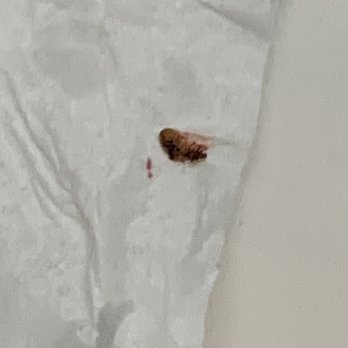 Harrah's Laughlin - A Caesars Rewards Destination - Smashed bed bug. Crawling on my sleeve as I watched tv in bed. - Hotels Near Me - Laughlin, Nevada Harrah's Laughlin - A Caesars Rewards Destination - Smashed bed bug. Crawling on my sleeve as I watched tv in bed. - Hotels Near Me - Laughlin, Nevada