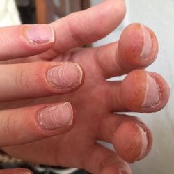 Ongles Kj Spa - 2.5 days after the manicure at Ongles KJ- not the discolouration at the end of my fingers and the shape of my nails.