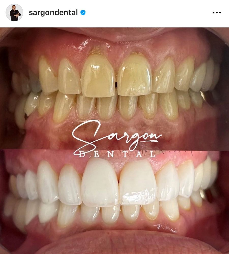 Sargon Dental