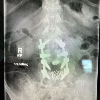 Pawel Jankowski, MD - Revision 6/2023. - Spine Surgeons Near Me - Irvine, California Pawel Jankowski, MD - Revision 6/2023. - Spine Surgeons Near Me - Irvine, California