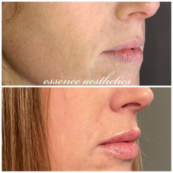 Essence Aesthetics - Medical Spas Near Me - Windsor, Colorado Essence Aesthetics - Medical Spas Near Me - Windsor, Colorado