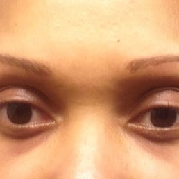Uneven eyebrows. Uneven eyebrows.